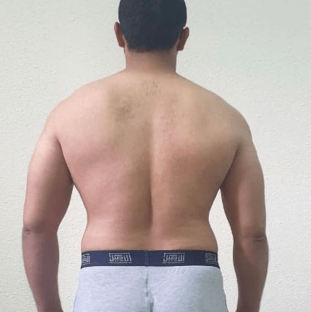 قبل - التحول 6